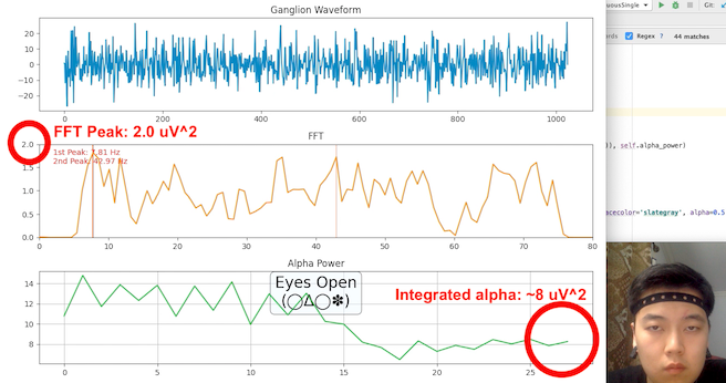 Graph of baseline alpha wave activity