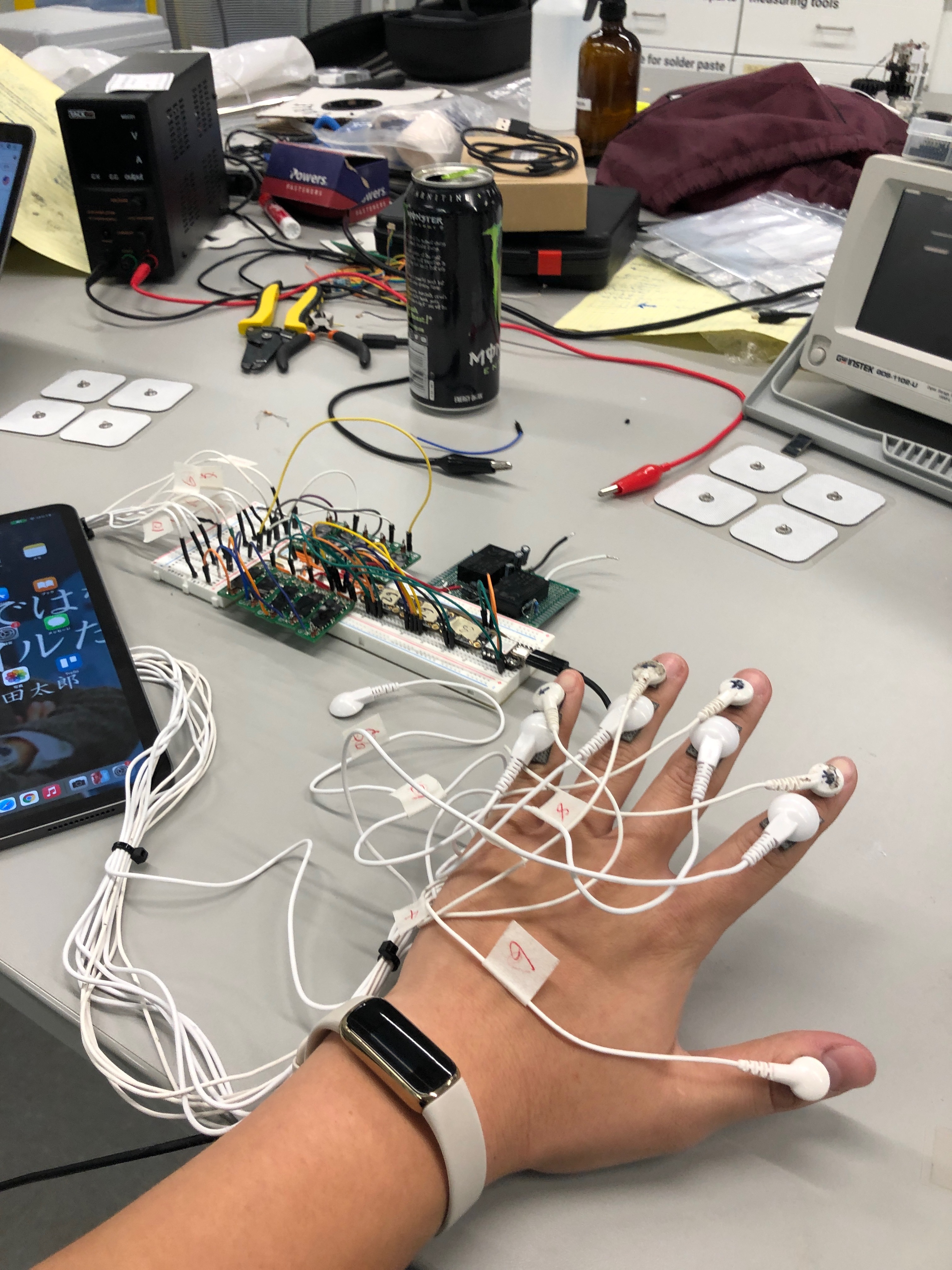 Full-hand setup for back-of-hand stimulation. Yeowch!