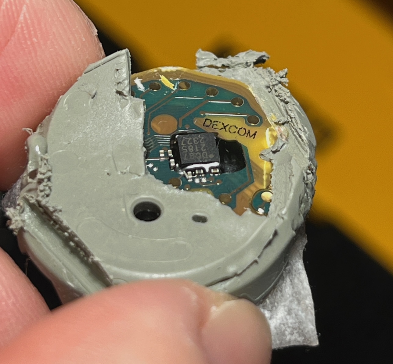 Stelo sensor with its gray rubber casing partly cut away, exposing the DEXCOM-marked circuit board
