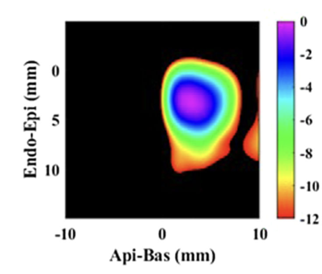 Colormap of cardiac peak voltages across the heart wall produced by acousto-electric imaging